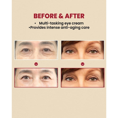 Crema Contorno Occhi Anti-Età al Retinolo – K-Secret Seoul 1988 Eye Cream 30ml